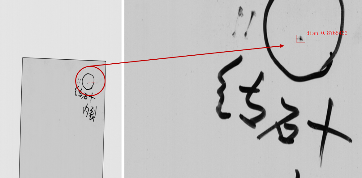 结石检测效果1028.png
